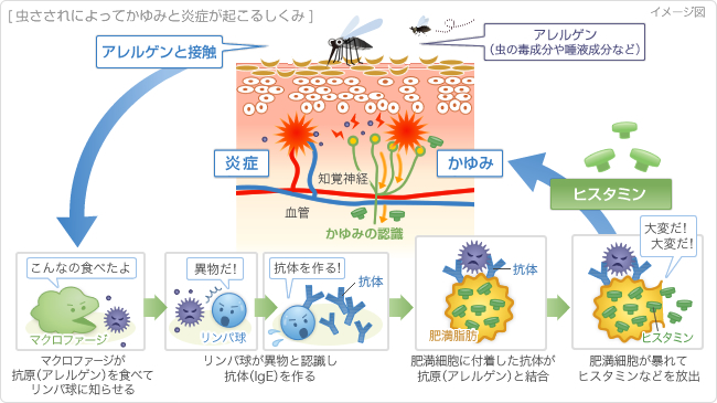 イメージ図:虫さされによってかゆみと炎症が起こるしくみ