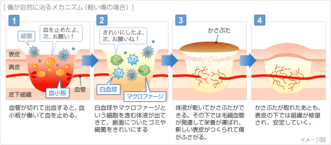 イメージ図:傷が自然に治るメカニズム(軽い傷の場合)