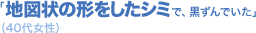 �u�n�}��̌`�������V�~�ŁA������ł����v�i40�㏗���j