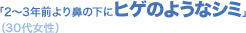 �u2�`3�N�O���@�̉��Ƀq�Q�̂悤�ȃV�~�v�i30�㏗���j