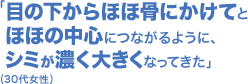 「目の下からほほ骨にかけてとほほの中心につながるように、シミが濃く大きくなってきた」(30代女性)