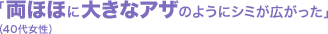 �u���ققɑ傫�ȃA�U�̂悤�ɃV�~���L�������v�i40�㏗���j