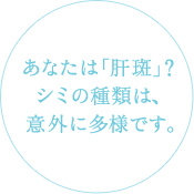 あなたは「肝斑」? シミの種類は、意外に多様です。