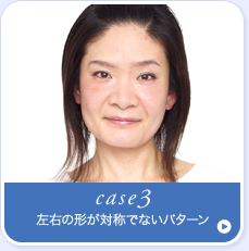 case3.���E�̌`���Ώ̂łȂ��p�^�[��