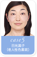 case5.�������q�i�V�l���F�f���j
