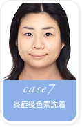 case7.���ǌ�F�f����