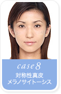 case8.�Ώ̐��^�烁���m�T�C�g�[�V�X