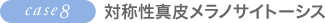 case8.�Ώ̐��^�烁���m�T�C�g�[�V�X