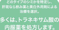 �ǂ̃^�C�v�̃V�~������肵�A�̔��Ȃ���ݖ�Ɣ����O�p�܂ɂ�鎡�Â�I���B�����́A�g���l�L�T���_�̓�������������܂��B