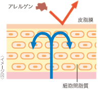 ノーマルスキン