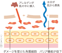 ドライスキン