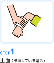 STEP1止血(出血している場合)