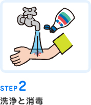 STEP2洗浄と消毒