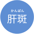 肝斑(かんぱん)
