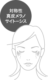 �Ώ̐��^�烁���m�T�C�g�[�V�X