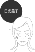 日光黒子
