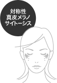 対称性真皮メラノサイトーシス