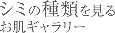 �V�~�̎�ނ����邨���M�������[