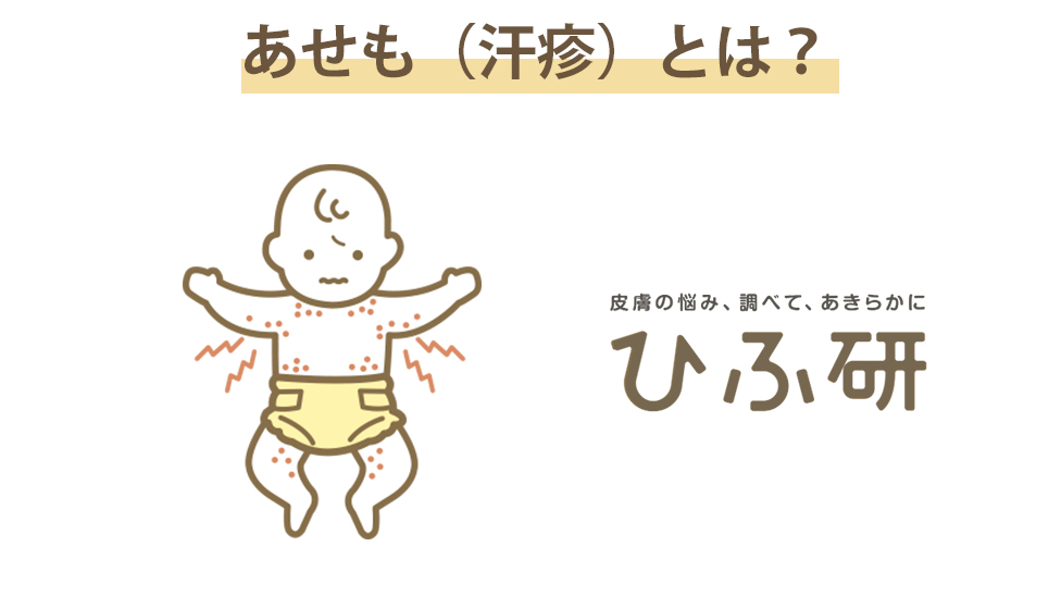 あせも（汗疹）とは？　あせも皮膚の悩み、調べて、あきらかに ひふ研