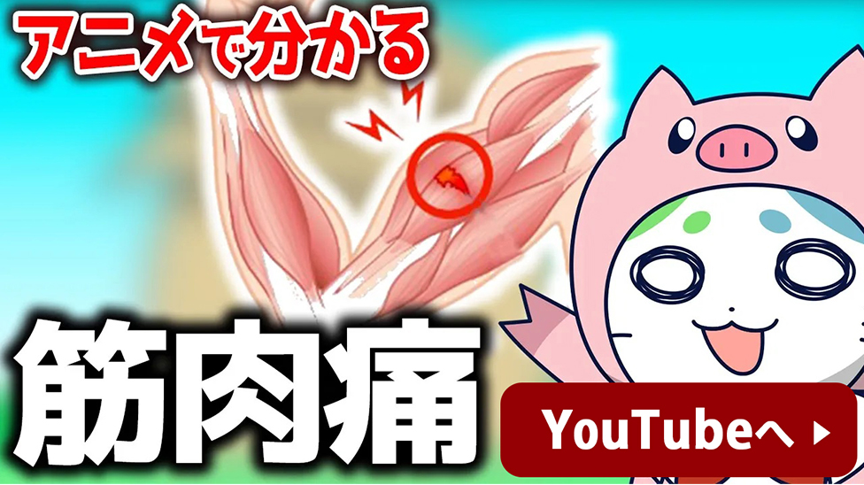 アニメで分かる　筋肉痛　YouTubeへ　新しいウィンドウで開く