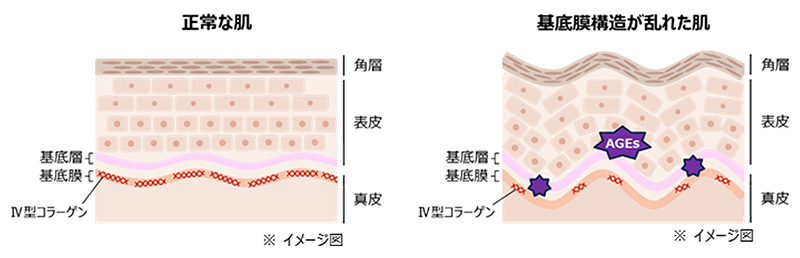 正常な肌 基底層 基底膜 角層 表皮 真皮 IV型コラーゲン ※イメージ図  基底膜構造が乱れた肌 基底層 基底膜 角層 表皮 AGEs 真皮 IV型コラーゲン ※イメージ図