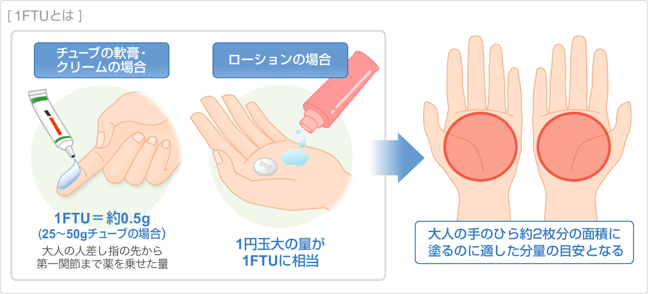 1FTUとは