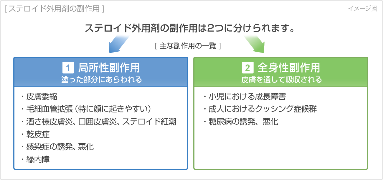 ステロイド外用剤の上手な使い方 くすりと健康の情報局