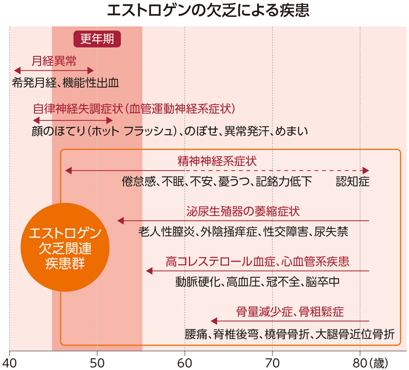 40代後半から始まる更年期のサインとは？ - ホットフラッシュの症状と原因