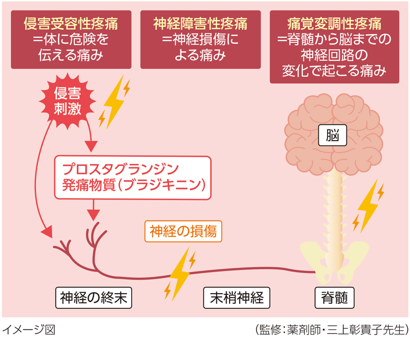 3つの痛みの種類のイメージ図／（監修：薬剤師・三上彰貴子先生）