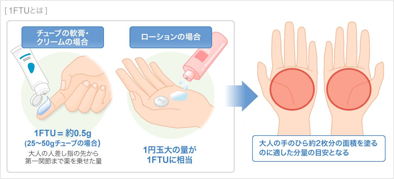 1FTUとは