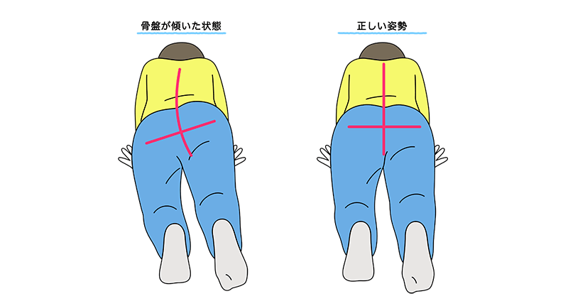 骨盤のぐらつきを説明するイラスト