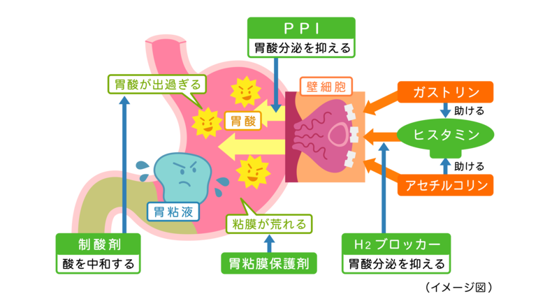 胃痛のときに選ぶ薬のタイプ
