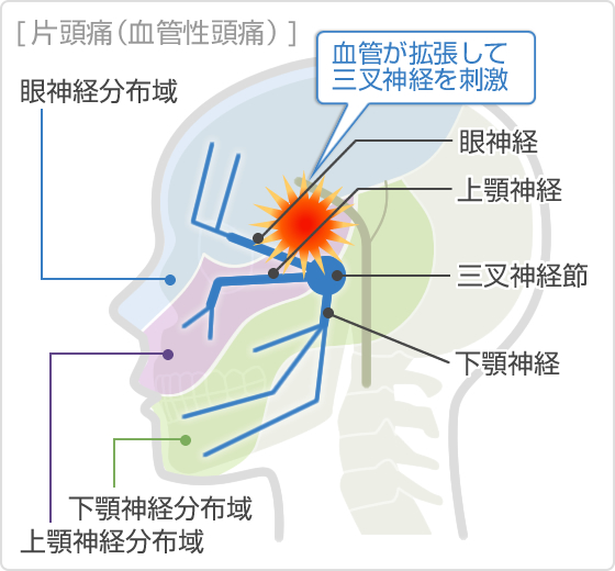 下 向 いたら 頭痛