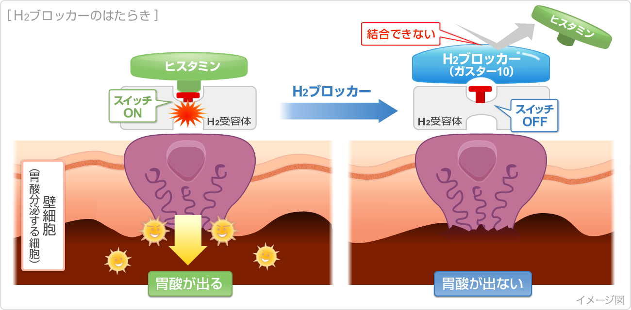 食事 胃 の が 時 痛い