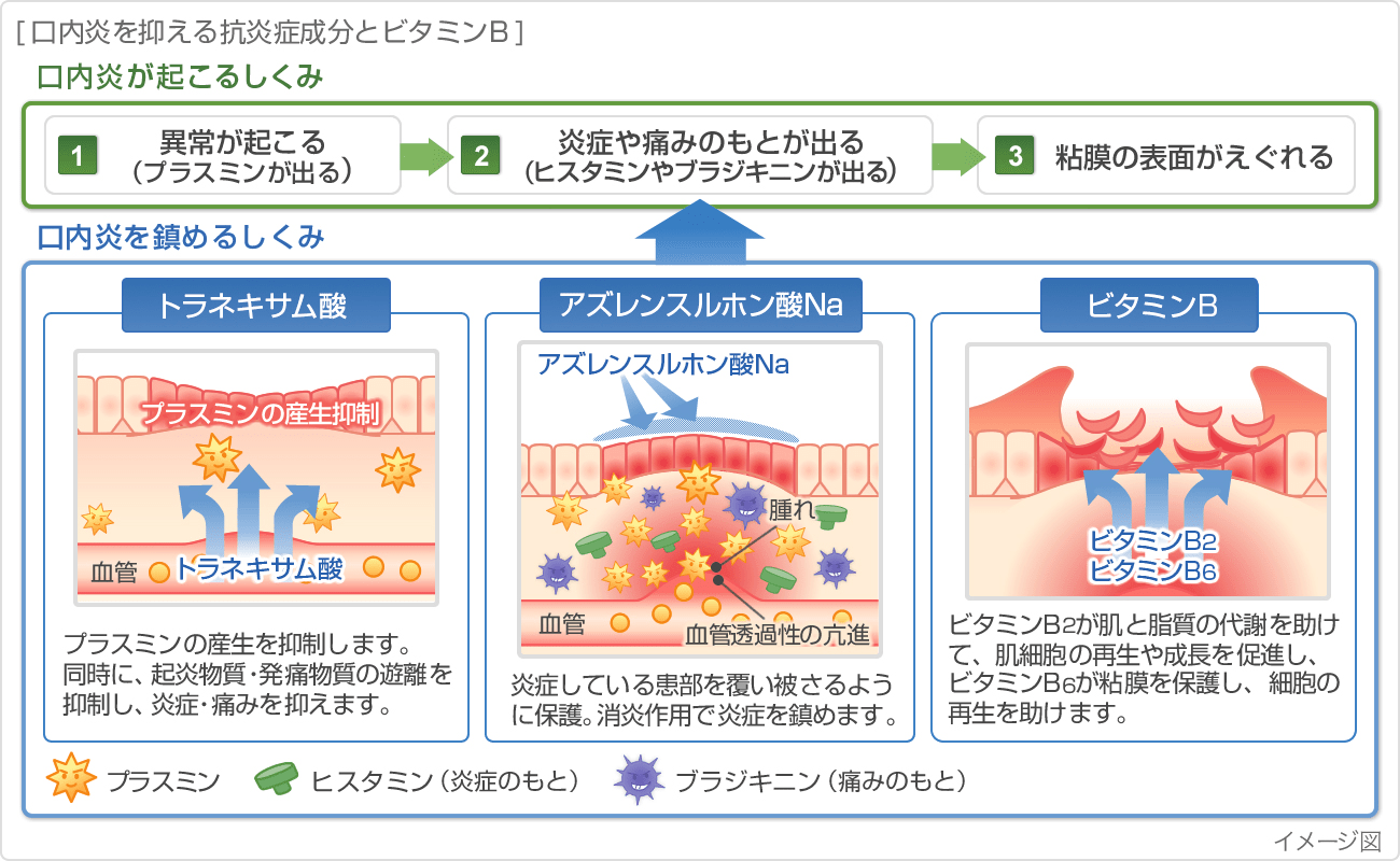 口内炎を抑える抗炎症成分とビタミンB