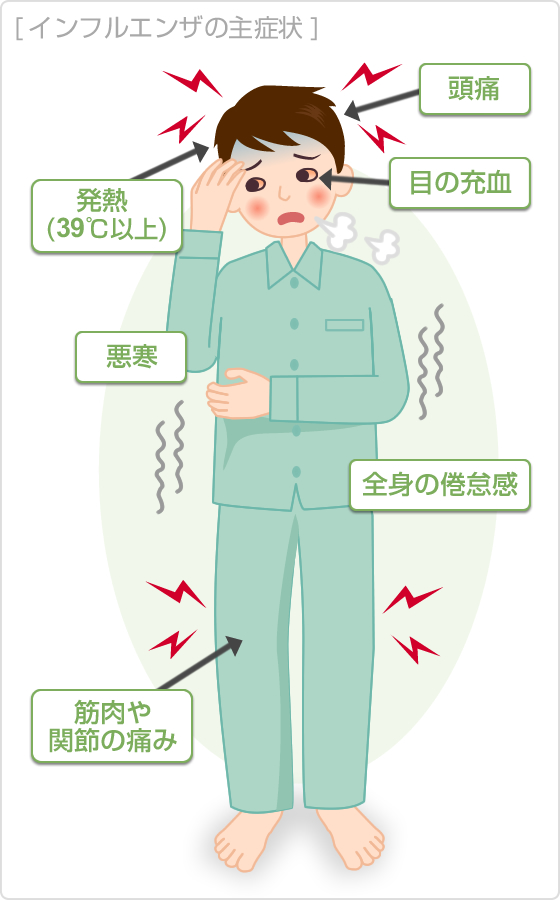 インフルエンザの症状 原因 くすりと健康の情報局