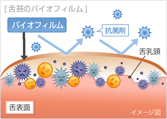 舌苔のバイオフィルム