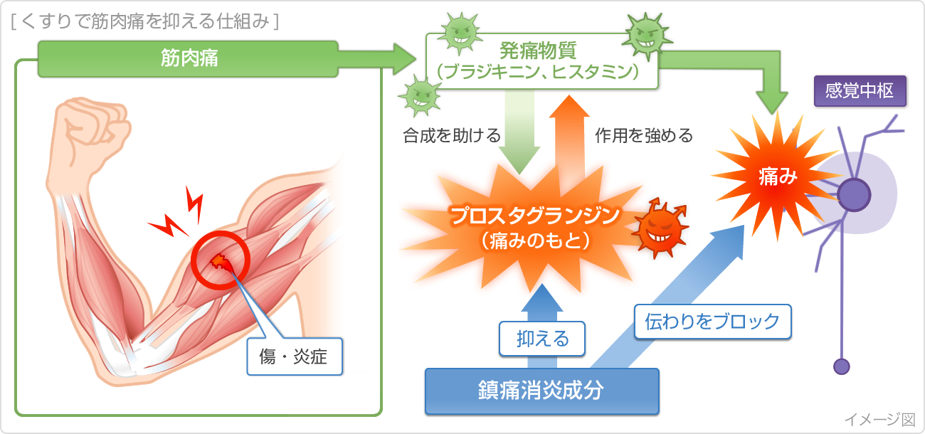 くすりで筋肉痛を抑える仕組み