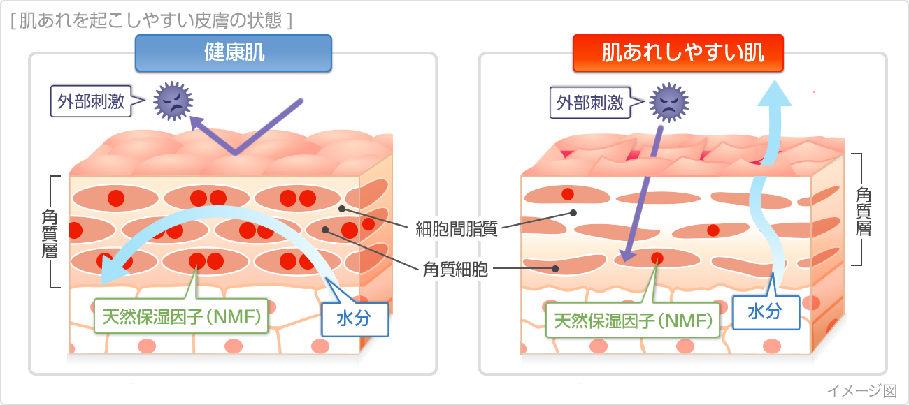 肌あれを起こしやすい皮膚の状態