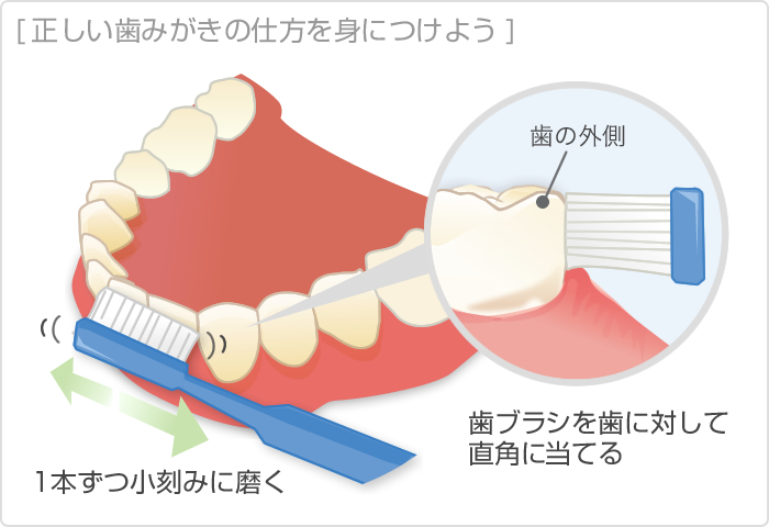 正しい歯みがきの仕方を身につけよう