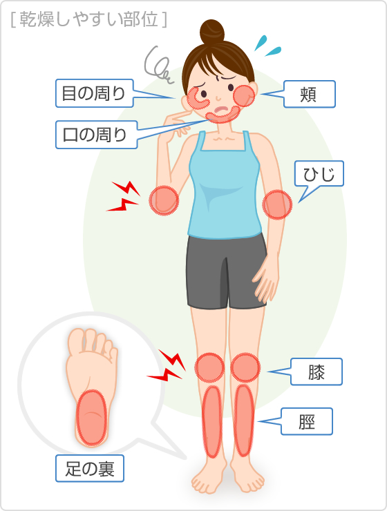 乾燥しやすい部位