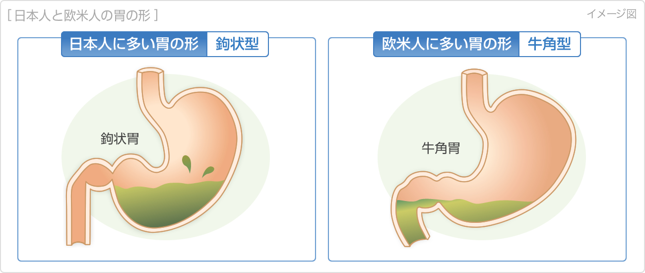 日本人と欧米人の胃の形