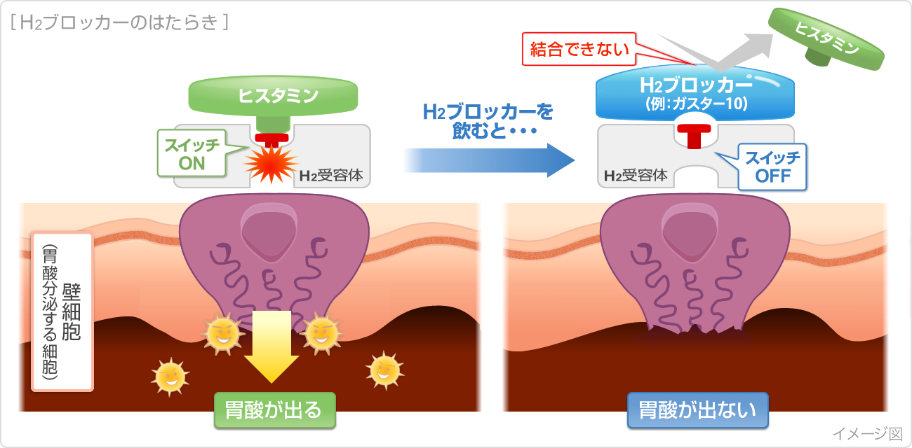 H2ブロッカーのはたらき