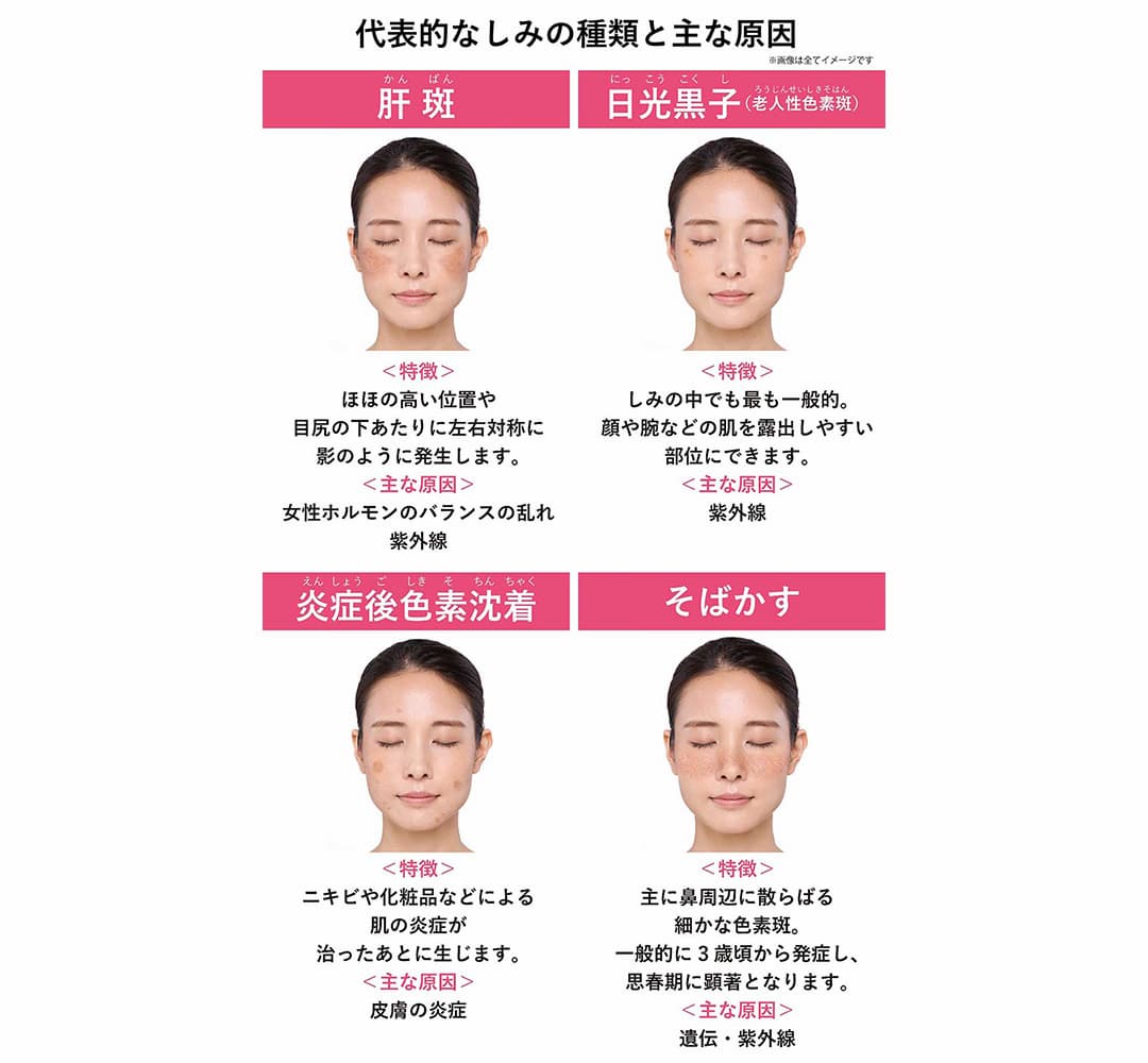 代表的なしみの種類と主な原因