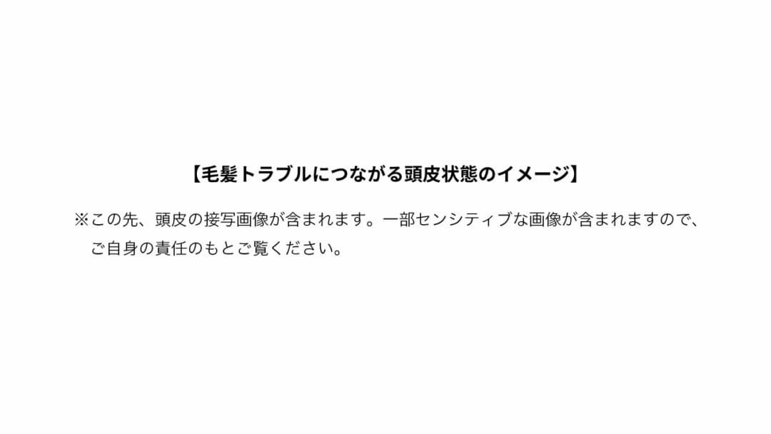 毛髪トラブルにつながる頭皮状態のイメージ