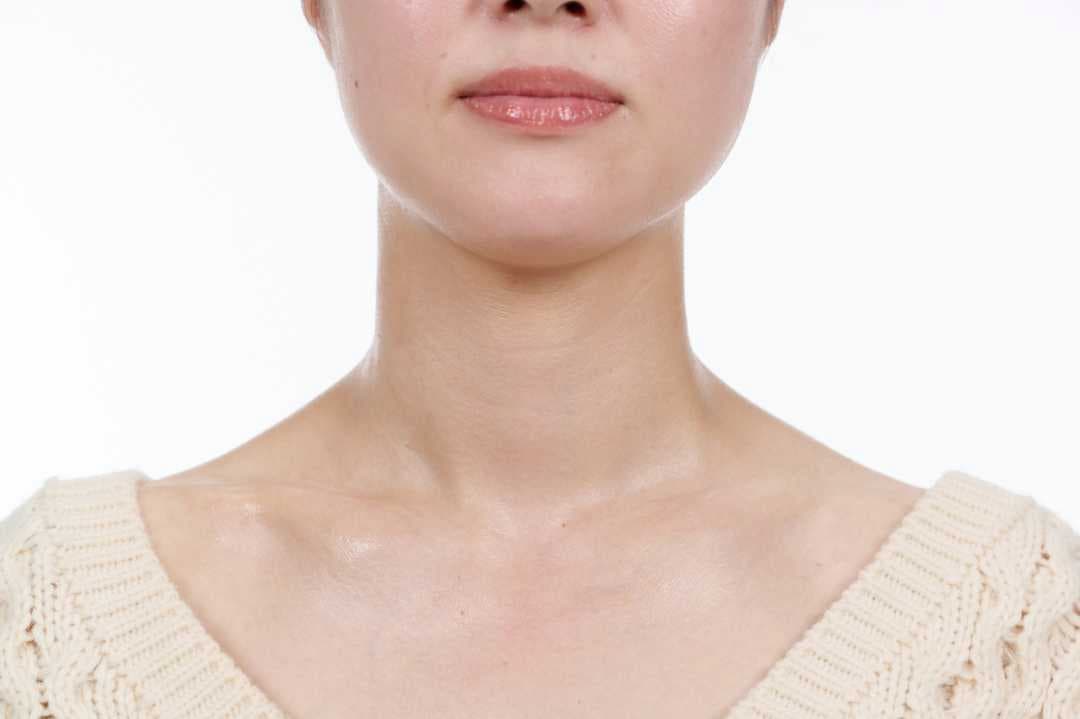 首、デコルテの写真。首まで保湿ケアをして、ふっくらとツヤやかな状態。