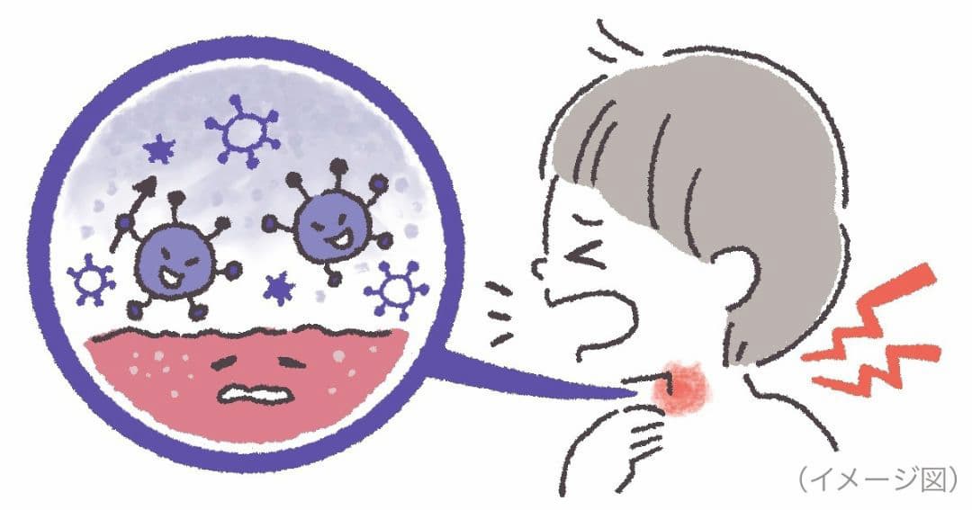喉風邪のイメージ