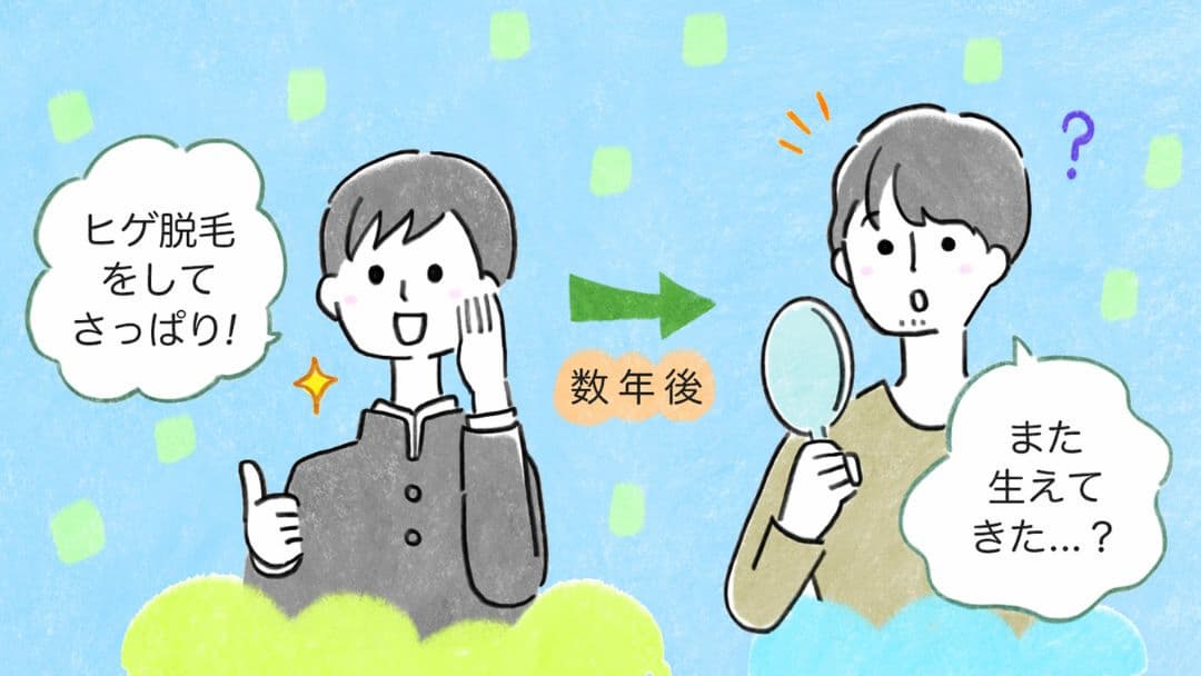 中学生でヒゲ脱毛をした男の子が成長をして、大学生になってまた少しヒゲが生え始めている様子