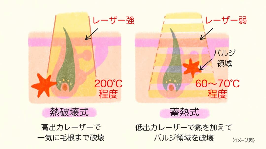 蓄熱式と熱破壊式の違いについてのイラスト
