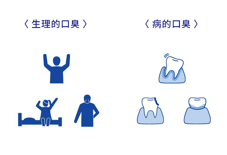 生理的口臭とは？ 病的口臭とは？